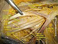 臂丛神经与腋动脉 (1)