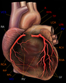 人類心臟及左右冠狀動脈，圖右可見左冠狀動脈