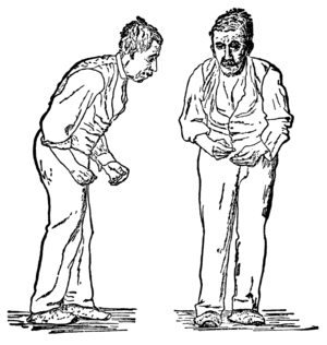 兩幅插畫分別由前面和右側描繪了同個男人，可見他面無表情、彎腰駝背、舉步維艱。