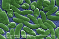 Image 9Vibrio vulnificus, a virulent bacterium found in estuaries and along coastal areas (from Marine prokaryotes)