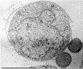 Image 103Two Nanoarchaeum equitans cells with its larger host Ignicoccus (from Marine prokaryotes)